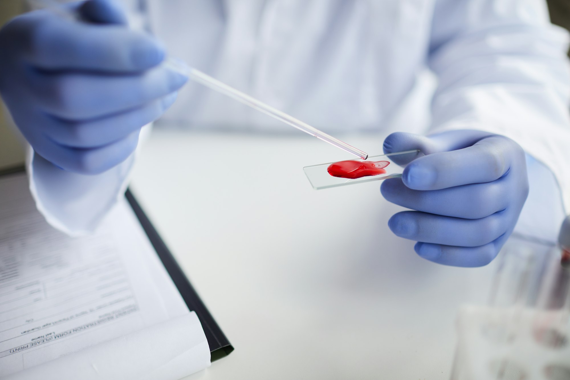 Cuál es el tipo de sangre más raro
