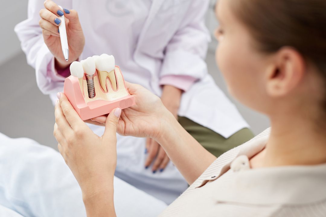 Cuánto cuesta un implante dental en Panamá