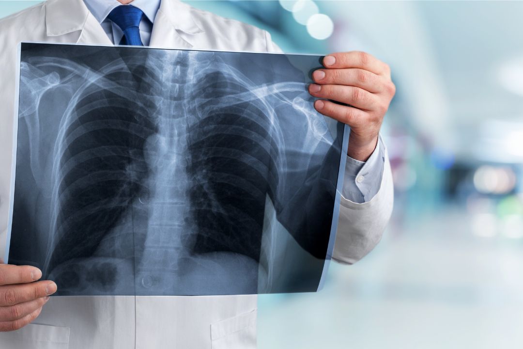 Cuánto cuesta una radiografía en Panamá