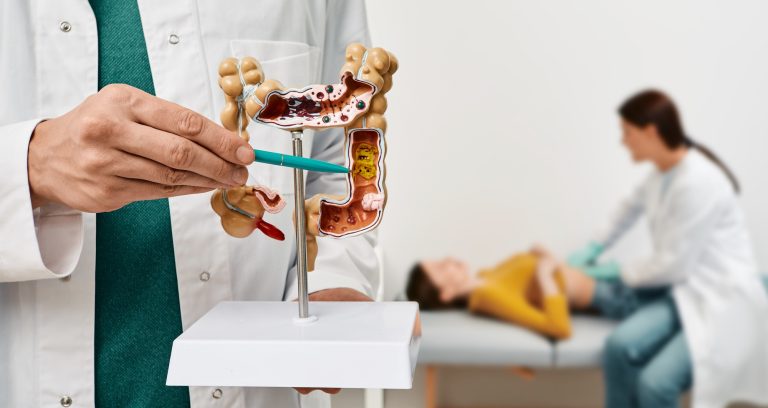 Anatomical intestines model with pathology in doctor hands. Gastroenterologist palpates patient